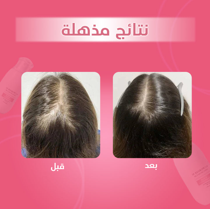 زيفتا إتش - ريجرو 2.0