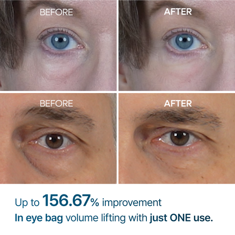 كريم دكتور ميلاكسين لعلاج أكياس العين